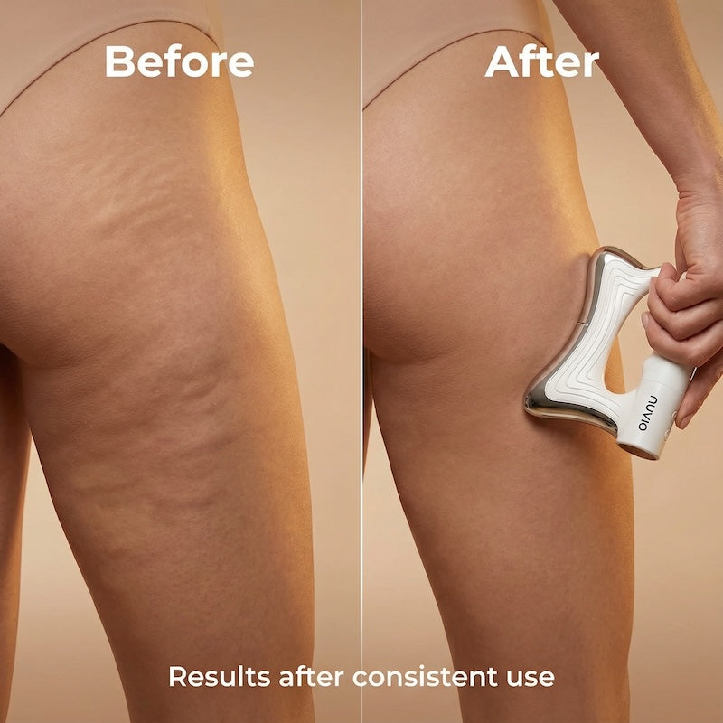 Nuvio Deep Fascia Sculptor